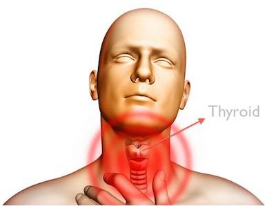 Signs That Hypothyroidism Disease May Have Been Missed by Your Doctor